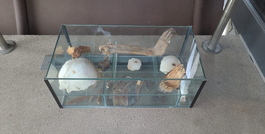 Витрина содержала человеческие останки и ткань